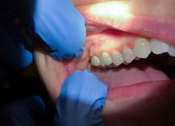 Best Emergency Treatment for Jaw Pain or Injury in Hurstbourne Acres, KY
