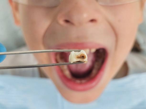 Best Emergency Treatment for Oral Infections in Hurstbourne Acres, KY